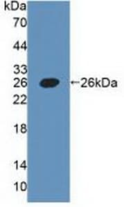 PDPN / Podoplanin Antibody (aa23-143)