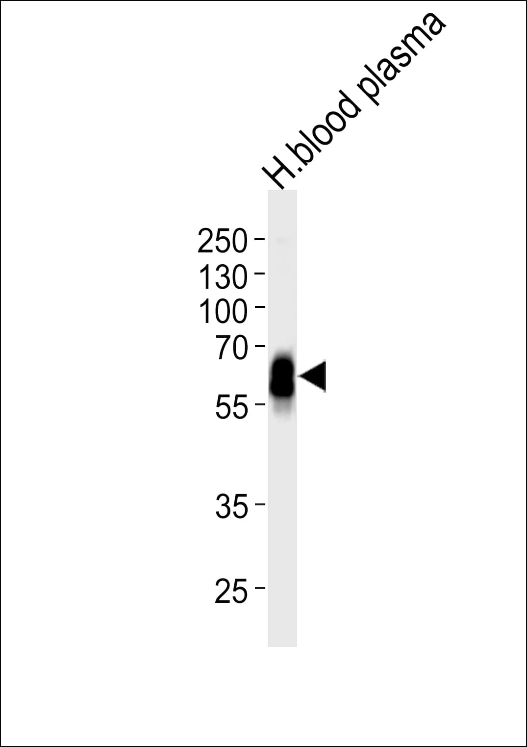 IHC-plus™ SERPINA6 / CBG Antibody (aa197-225)
