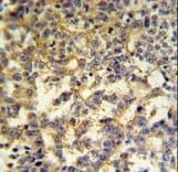 G6PD Antibody (aa297-326)