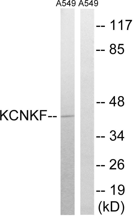 KCNK15 Antibody