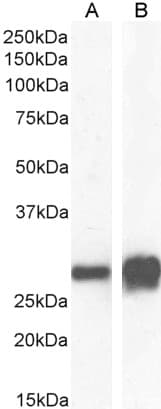 IHC-plus™ Polyclonal Goat anti-Human SFN / Stratifin / 14-3-3 Sigma Antibody (aa204-217, IHC, WB)