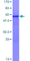 Human TTPA Protein (Recombinant GST)