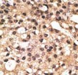 Polyclonal Rabbit anti-Human APG4B / ATG4B Antibody (aa16-45, IHC, WB)