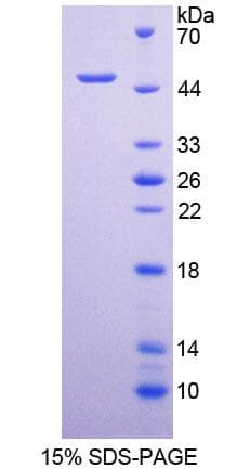 Human VPS37A Protein (Recombinant His-T7)
