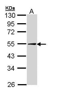 PathPlus™ Polyclonal Rabbit anti-Human PLIN2 / ADFP / Adipophilin Antibody (IHC, WB)