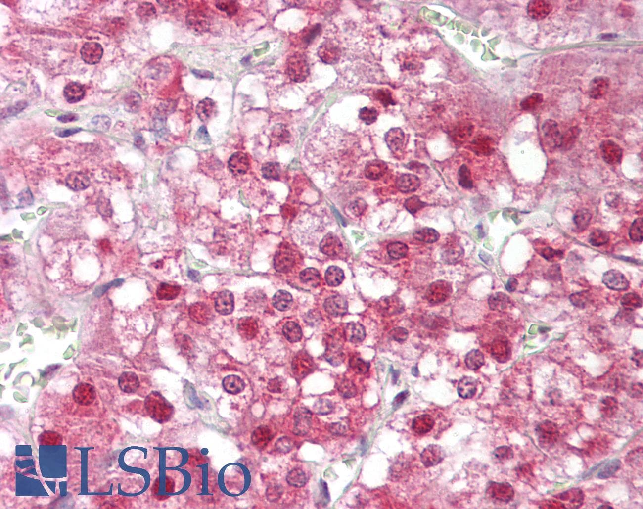 IHC-plus™ Polyclonal Rabbit anti-Human HSF1 Antibody (aa270-319, IHC, WB)