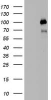 PR / Progesterone Receptor Antibody (aa1-298, clone OTI6E3)