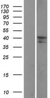 ST3GAL3 / ST3N Protein (Over-Expression Lysate Myc-DDK (Flag))