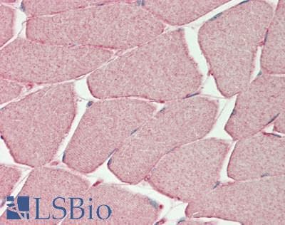 Polyclonal Rabbit anti-Rat PHKG1 Antibody (aa68-117, IHC, WB)