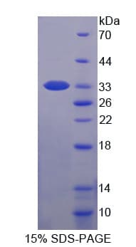 Human MYLK2 Protein (Recombinant His-T7)