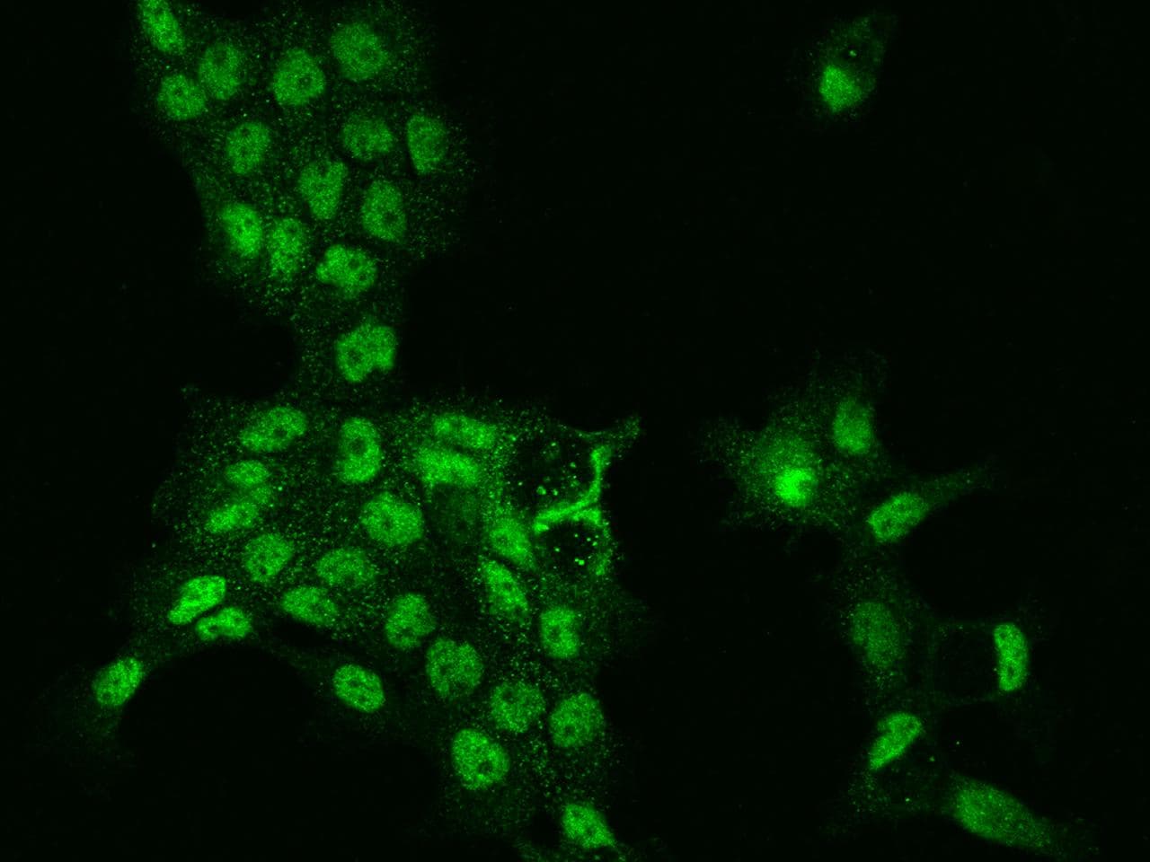 Polyclonal Rabbit anti-Human PDS5A Antibody (IF, WB)