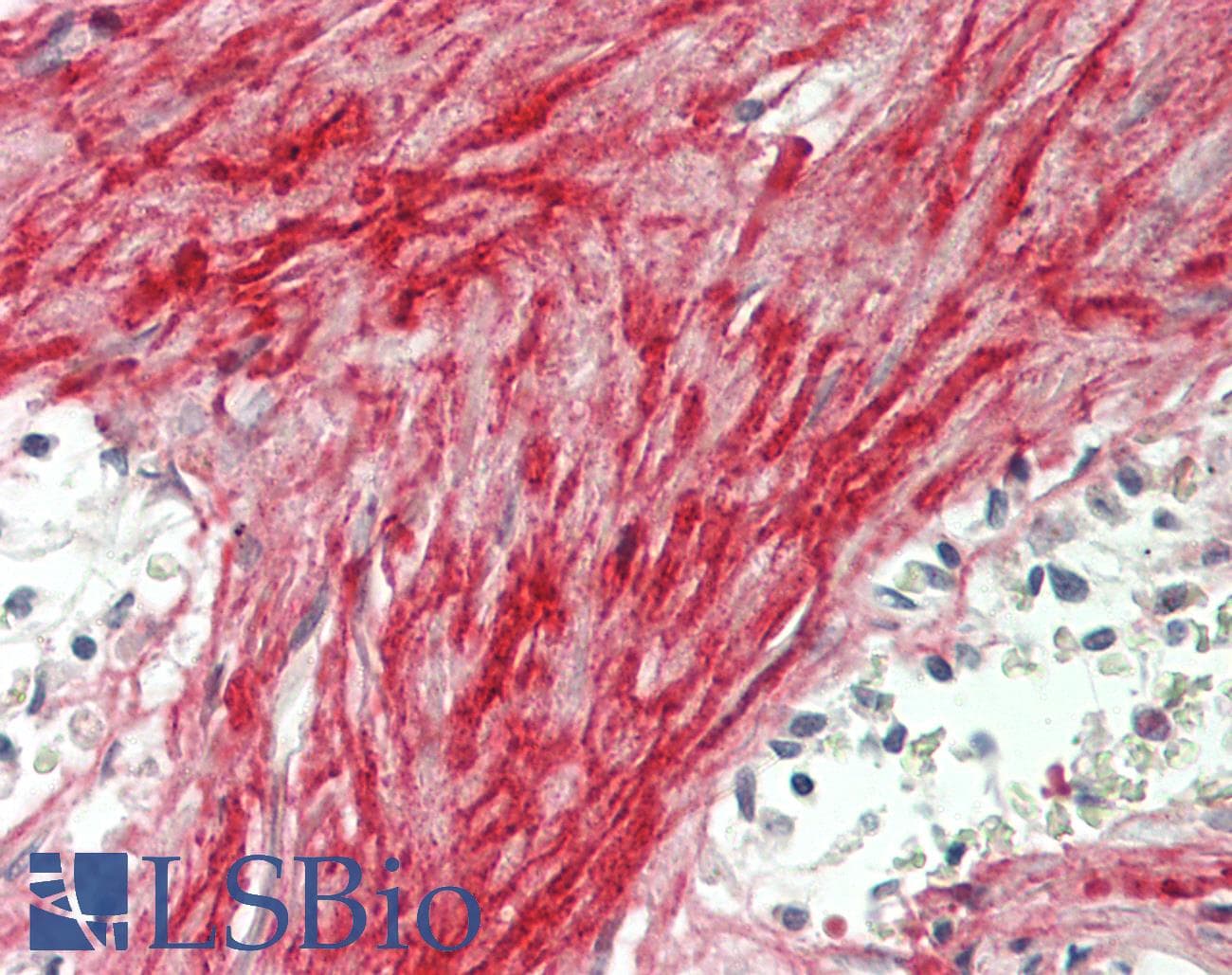 Polyclonal Rabbit anti-Human BGN / Biglycan Antibody (aa230-366, IHC, WB)