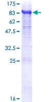 Human RPN2 / Ribophorin II Protein (Recombinant GST)