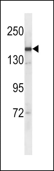 Polyclonal Rabbit anti-Human SYCP2 / SCP-2 Antibody (aa1345-1372, WB)