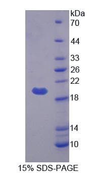 Human BEST4 Protein (Recombinant His, N-Terminal)