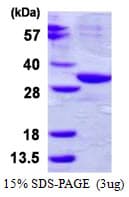 Human ABHD10 Protein (Recombinant His)