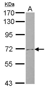Polyclonal Rabbit anti-Human SLC4A8 / NBC Antibody (N-Terminus, WB)