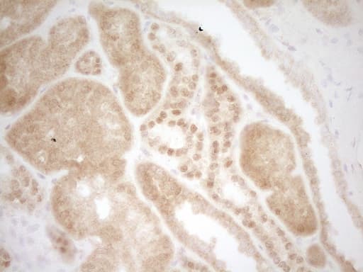BSAC / MKL1 Antibody (aa165-397, clone OTI3G7)