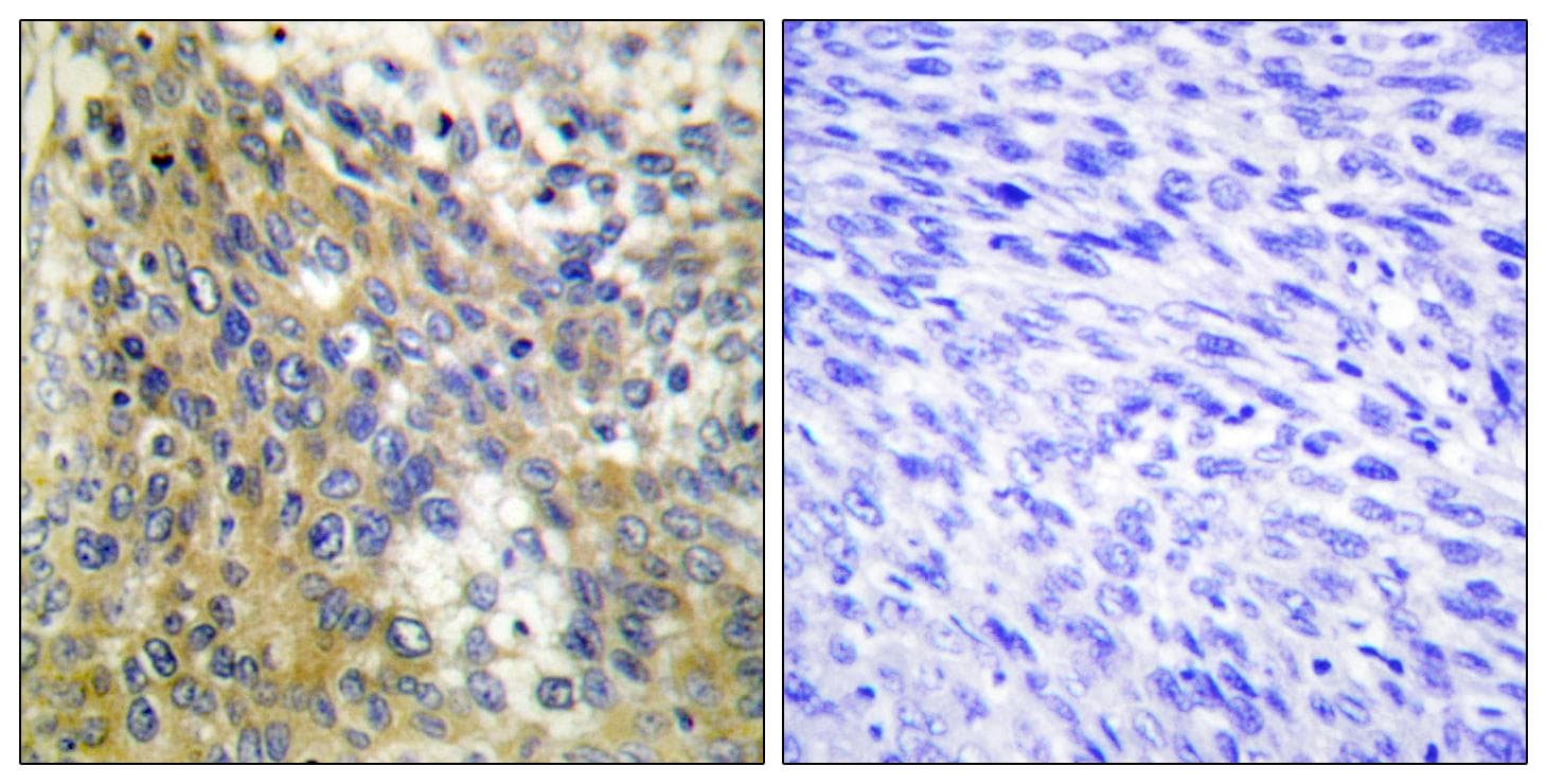 COL4A6 / Collagen IV Antibody