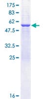 Human SPR Protein (Recombinant GST)