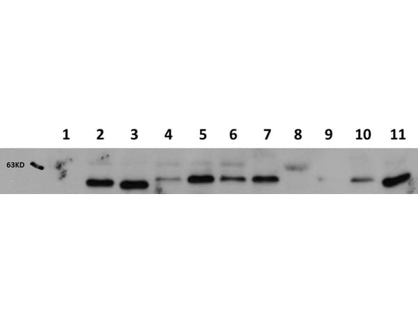 AKT1 Antibody (Internal, clone 14E5.A2.B2.H9)