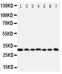 Polyclonal Rabbit anti-Human KLK11 / Kallikrein 11 Antibody (aa233-250, IHC, WB)