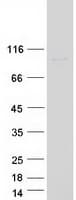 Human DHX40 Protein (Recombinant Myc-DDK (Flag))