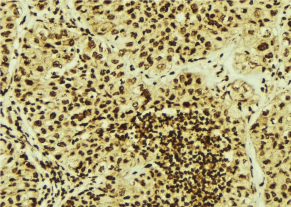 PSMB5 Antibody