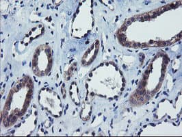 COMMD1 Antibody (clone OTI2D10)