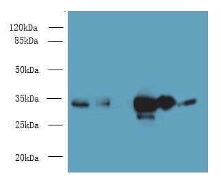 Polyclonal Rabbit anti-Human EAPP Antibody (IHC, WB)