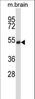 TFB1 / GTF2H1 Antibody (aa84-112)
