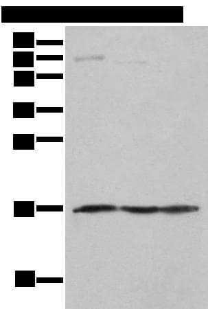 Polyclonal Rabbit anti-Human NDUFA12 / B17.2 Antibody (IHC, WB)