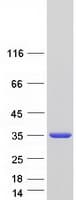 Human FAHD1 Protein (Recombinant Myc-DDK (Flag))
