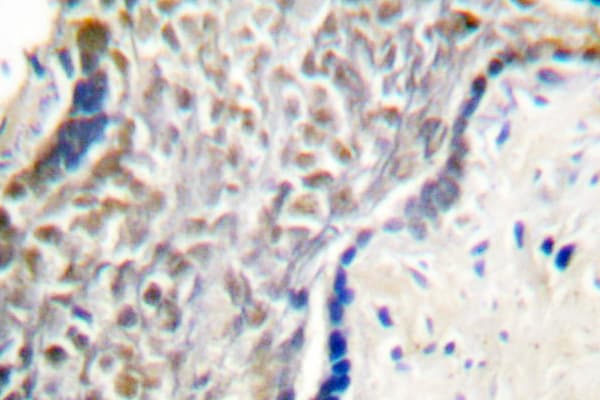 p14ARF / CDKN2A Antibody (Gln99)