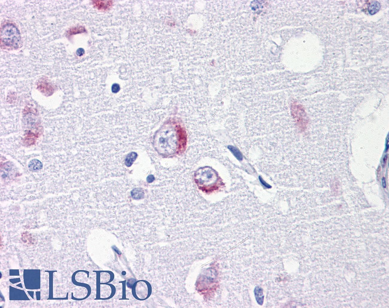 IHC-plus™ Monoclonal Mouse anti-Human DARS Antibody (clone 2F11, IHC, WB)