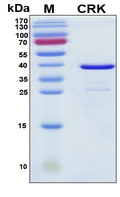 Human CRK Protein (Recombinant His, N-Terminal)