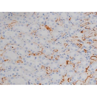 SNCA / Alpha-Synuclein Antibody (phospho-Ser129)