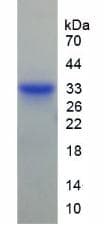 Human MMP7 / Matrilysin Protein (Recombinant His, N-terminus)