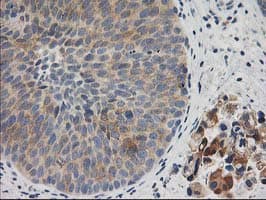 BAIAP2 / IRSP53 Antibody (clone OTI8G8)