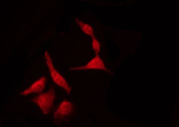 Polyclonal Rabbit anti-Human TP53 / p53 Antibody (phospho-Ser46, IF, WB)