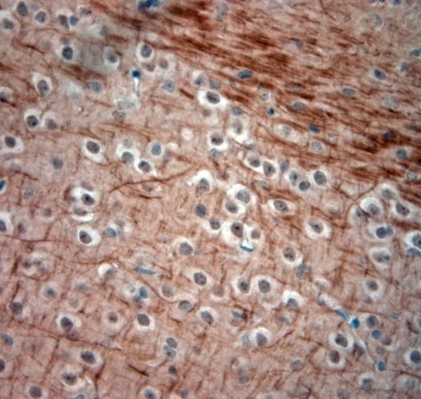 NEFH / NF-H Antibody (aa150-200)