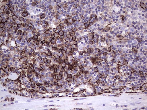 PECAM-1 / CD31 Antibody (clone UMAB164, Carrier-free)
