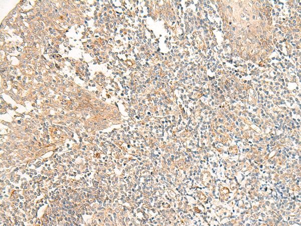 GPR44 / CRTH2 Antibody