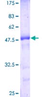 Human CRADD / RAIDD Protein (Recombinant GST)