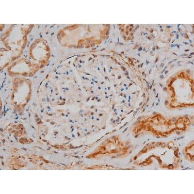 CREB1 / CREB Antibody (phospho-Ser133)