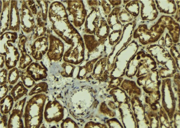 MAGEA1 / MAGE 1 Antibody