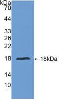 Human IL24 Protein (Recombinant His, N-Terminal)