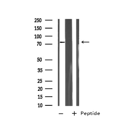 Polyclonal Rabbit anti-Human RHOBTB2 / DBC2 Antibody (IF, WB)