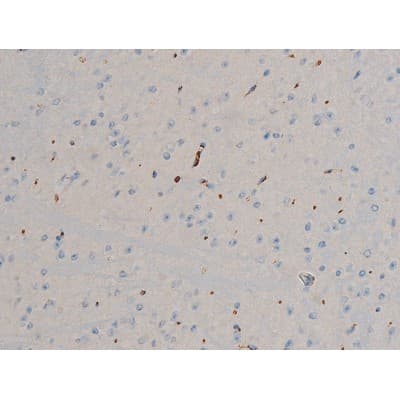Polyclonal Rabbit anti-Human BCL2 / Bcl-2 Antibody (phospho-Ser70, IHC, IF, WB)