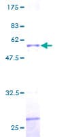 Human PPP6C Protein (Recombinant GST)